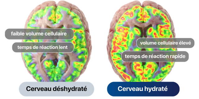 Son impact sur votre cerveau
